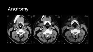Imaging of Larynx   Dr Mamdouh Mahfouz