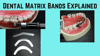 What is a dental matrix band