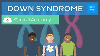 Down Syndrome: Definition, causes, symptoms, diagnosis  | Kenhub