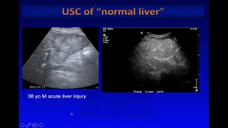 USG contrast and application