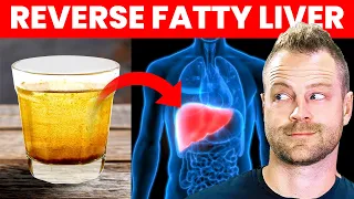 FASTEST Way to Clean Out Your Liver in 14 Days [1 Cup Daily]