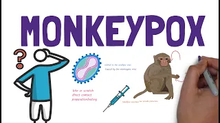 What is Monkeypox? | A quick overview