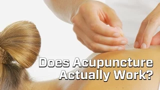 Junk Science Episode 11: Acupuncture