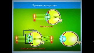 Основы Рефракции и аккомодации