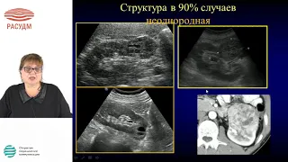 Мультипараметрическое ультразвуковое исследование желудка при опухолевом почек