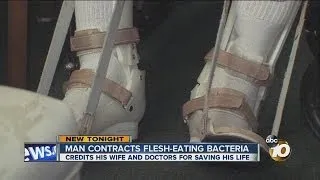 Oceanside man survives flesh-eating bacteria