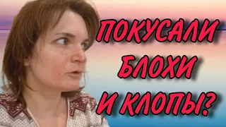 ЛЕНКУ ПОКУСАЛИ БЛОХИ И КЛОПЫ! VREDINA LIFE. ОБЗОР.