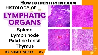 Histology of spleen, thymus, lymph node and tonsil