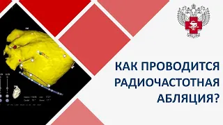 Абляция предсердия с использованием систем трехмерного навигационного картирования