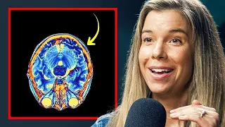 How To Stop Getting Brain Fog All The Time - Dr Rhonda Patrick