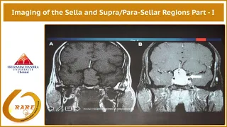Imaging of the Sella and Supra/Para-Sellar Regions Part - I