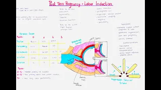 postterm pregnancy + labor induction