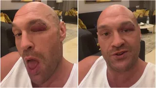 “USYK IS CRYING THE MOTHERF*****R, SH** HAPPENS” Tyson Fury BREAKS SILENCE | ANNOUNCES NEW DATE