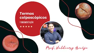 Termos colposcópicos [fundamentação]