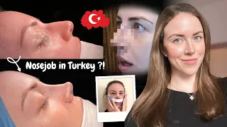 I Got a Nose Job in Istanbul | Turkey Rhinoplasty Vlog 2024