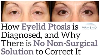 How Eyelid Ptosis is Diagnosed, and Why Non-Surgical Solutions Can't Correct It