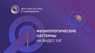 Физиологические паттерны на Видео ЭЭГ