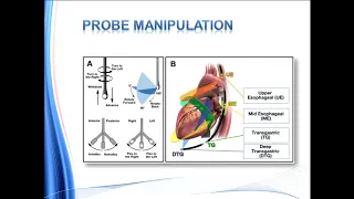 Transesophageal Echo, TEE ( ASE/SCA Guidelines for Performing a Comprehensive exam )