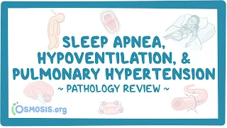 Apnea, hypoventilation, and pulmonary hypertension: Pathology Review