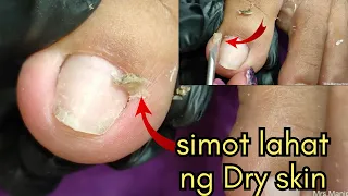 Vlog 816|Dry Skin/Ingrown Removal| PEDICURE 716
