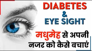 How to save eyesight from Diabetes | Diabetic Retinopathy | जानिए शुगर की बीमारी से कैसे बचाएं नजर