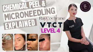 Chemical Skin Peel & Microneedling - Level 4 Certificate VTCT(ITEC) | Our Course Structure Explained