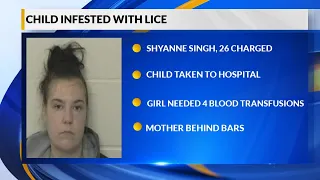 Digital Desk: Woman charged after daughter nearly died from lice