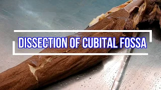 Dissection of Cubital fossa
