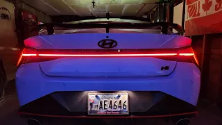 Hyundai Elantra N/ Update on  Carbon accent Interior pcs and future mods to come!