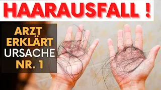 Plötzlich büschelweise HAARAUSFALL! Arzt erklärt Grund für Haarverlust (kein Vitaminmangel!)