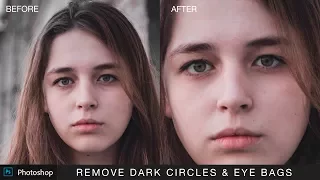 Photoshop Tutorial : Remove Dark Circles and Bags Under Eyes - Using Fade Selection Tool