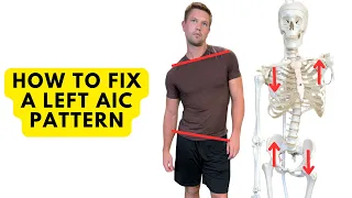 How To Fix A Left AIC Pattern - Steps For Resolving Asymmetry