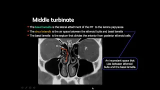 Dr Mamdouh Mahfouz head and neck imaging sinonasal imaging