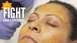 CHEMICAL PEELS CAN DO WHAT?!😲 Dr. Qazi's Customized Skincare Treatment