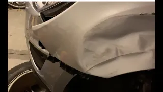 Chevy Equinox 2016 Driver Fender Removal