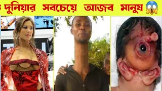 এমন মানুষ দেখতেও কপাল লাগে 😱 দুনিয়ার সবচেয়ে অদ্ভুত ১০ মানুষ Unusual human