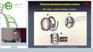 Фесенко В Н - Обструктивная азооспермия: восстановление проходимости или применение вспомогательных