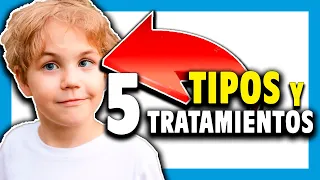 🔵 Tipos de ESTRABISMO y TRATAMIENTOS para cada desviación