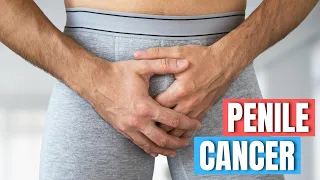 How to prevent Penis Cancer - Doctor Explains