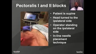 Webinar: Ultrasound-Guided Pectoralis I and II Blocks