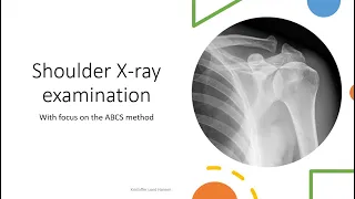 Shoulder X-ray interpretation/examination (ABCS method)