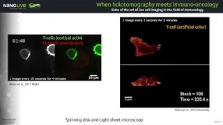 Webinar | Label-free live cell imaging meets Immuno-Oncology