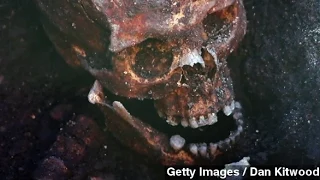 King Richard III's Painful Cause Of Death Revealed