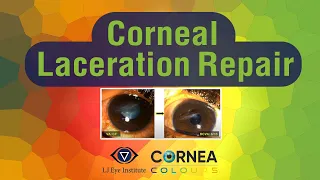 Cornea Colours | Corneal Laceration Repair
