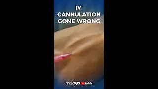 IV Cannulation gone wrong?