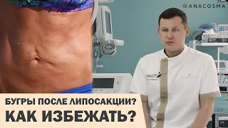 БУГРЫ, НЕРОВНОСТИ ПОСЛЕ ЛИПОСАКЦИИ ⛔️ ЧТО ДЕЛАТЬ ❓