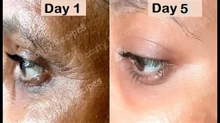 Remove Under Eye WRINKLES, Under Eye Bags, Puffy eyes & Dark Circles - Green Tea Eye Mask