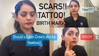 Should a Cabin Crew’s skin be flawless? | What if you have Scars, Tattoos & Birthmarks | Air hostess