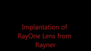 Insertion of RayOne IOL from Rayner