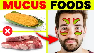 Top 14 Foods That Cause MUCUS You Must Avoid